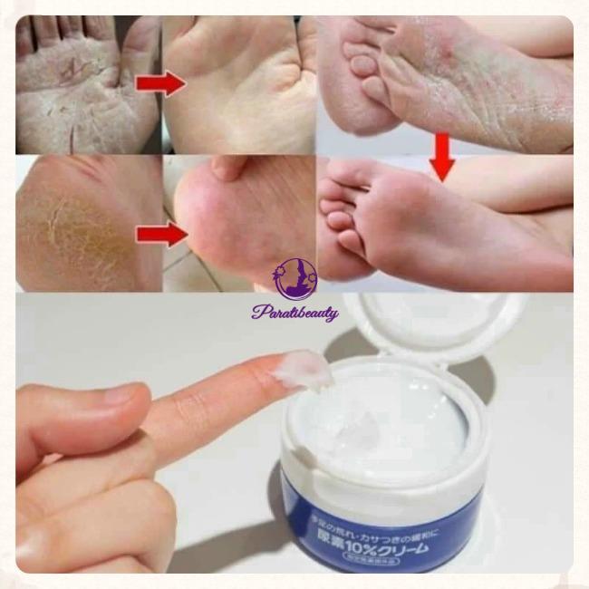 14.10 Kem Trị Nứt Nẻ Gót Chân, Ngón Tay Shishedo Urea 10% Cream Nhật Bản