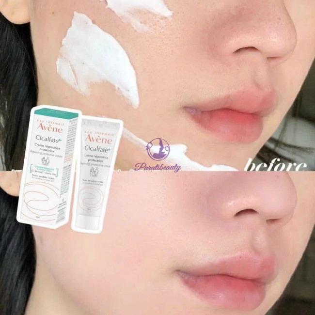 Kem Dưỡng Trị Thâm Tái Tạo Da Avène Cicalfate Restorative Skin Cream 40ml - Date T6/2025