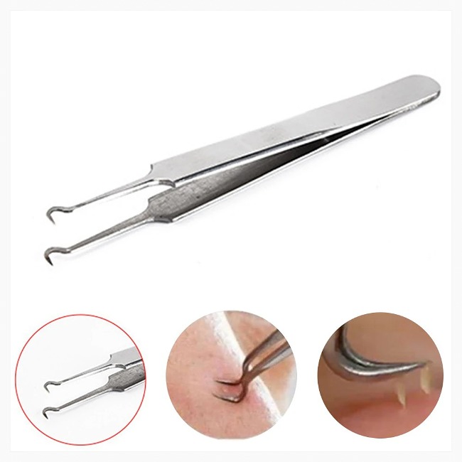 Nhíp gắp mụn Suri
