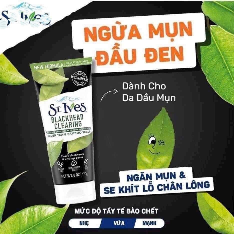 Sữa Rửa Mặt Sạch Mụn Đầu Đen Trà Xanh & Than Tre St.Ives 170g