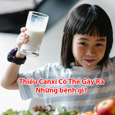 Thiếu Canxi Gây Ra Những Bệnh Gì Và 5 Biểu Hiện Của Trẻ Thiếu Canxi