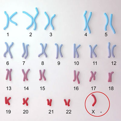 Quá trình xác định giới tính của thai nhi là trai hay gái