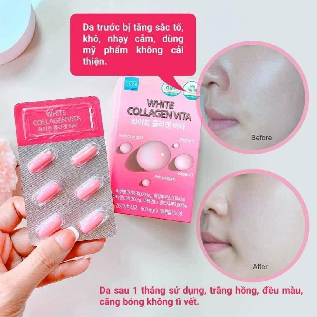 VIÊN TRẮNG DA WHITE COLLAGEN VITA 30 viên