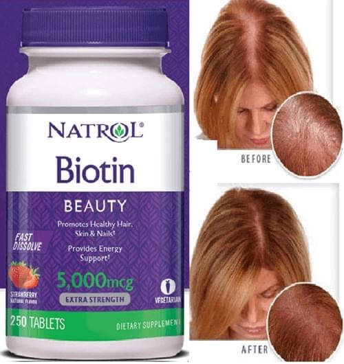 Biotin kích mọc tóc Natrol 10000mcg