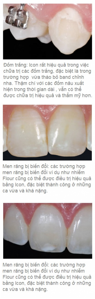  Dieu tri dom trang bang icon smooth surface DMG, tay dom trang icon, xu ly dom trang icon, loai bo dom trang icon DMG, Icon DMG chinh hang, Icon DMG uu dai (3)