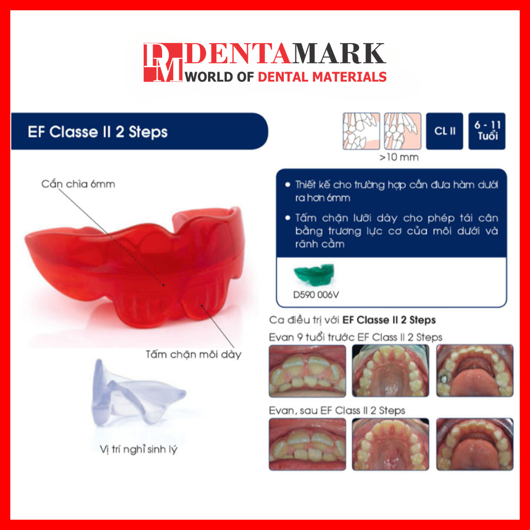 Hàm định hình khớp răng EF Line Orthoplus