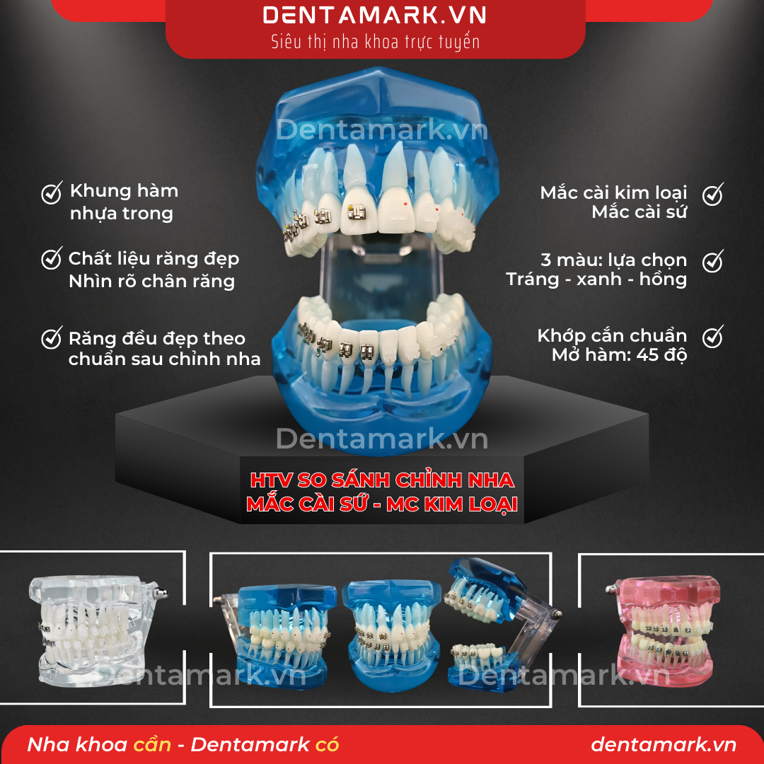 Mau ham tu van nha khoa, ham tu van benh nhan - Ham tu van chinh nha, ham tu van chinh nha mac cai kim loai, ham tu van chinh nha mac cai su, ham tu van so sanh chinh nha mac cai kim loai va mac cai su (1)