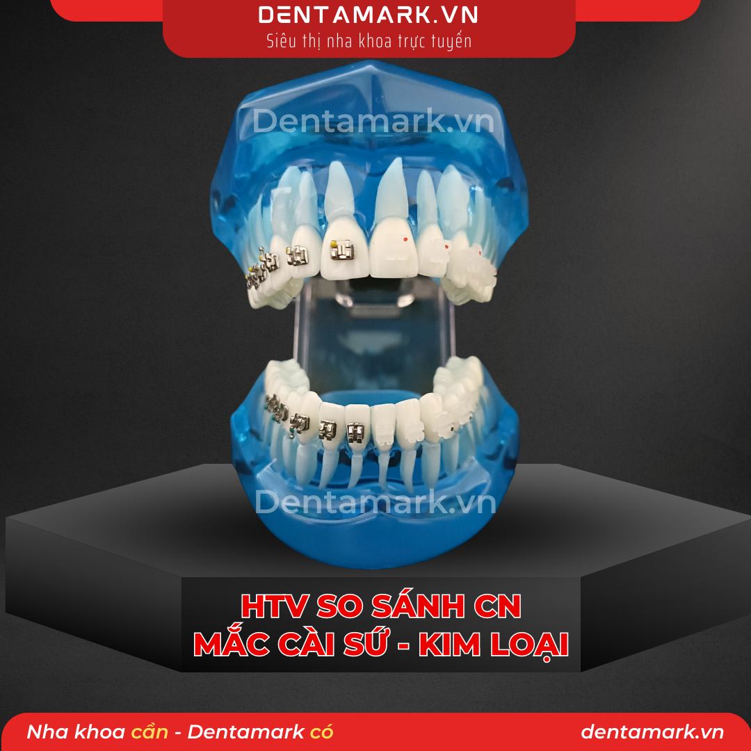 Mau ham tu van nha khoa, ham tu van benh nhan - Ham tu van chinh nha, ham tu van chinh nha mac cai kim loai, ham tu van chinh nha mac cai su, ham tu van so sanh chinh nha mac cai kim loai va mac cai su (1)