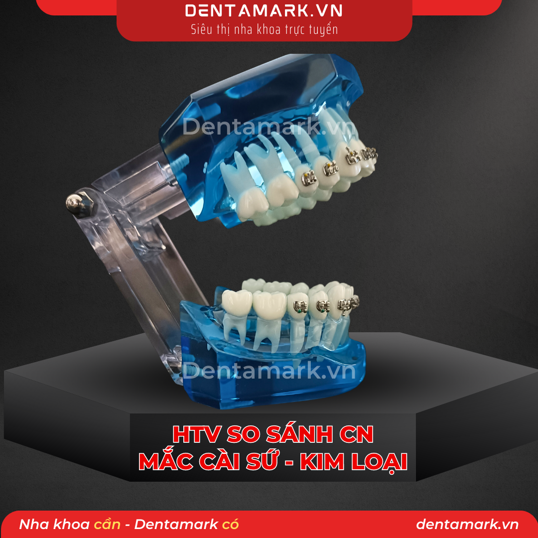 Mau ham tu van nha khoa, ham tu van benh nhan - Ham tu van chinh nha, ham tu van chinh nha mac cai kim loai, ham tu van chinh nha mac cai su, ham tu van so sanh chinh nha mac cai kim loai va mac cai su (1)