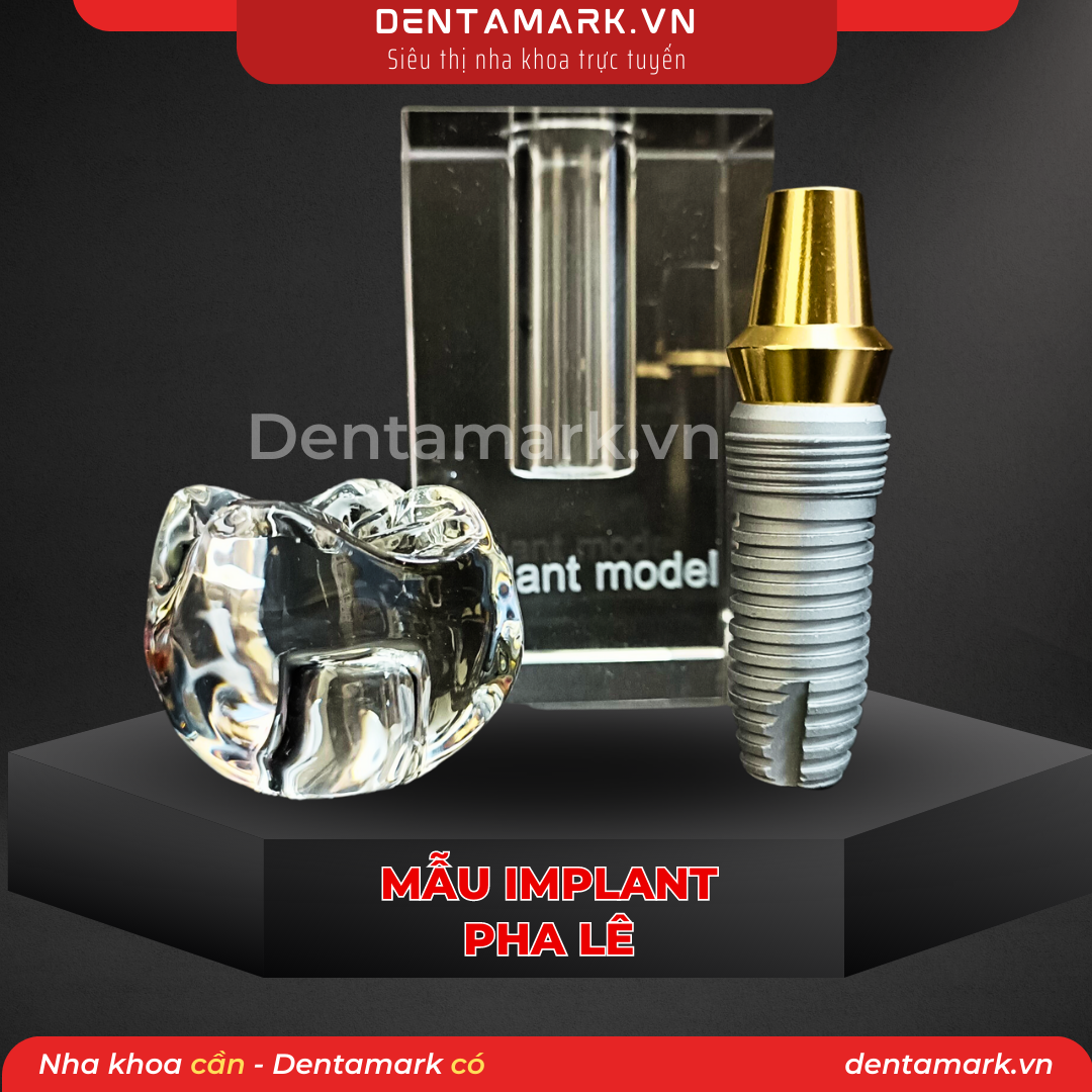 Mau ham tu van nha khoa, ham tu van benh nhan - Trang tri nha khoa, Mau Implan pha le, mo hinh tu van implant bang pha le (1)