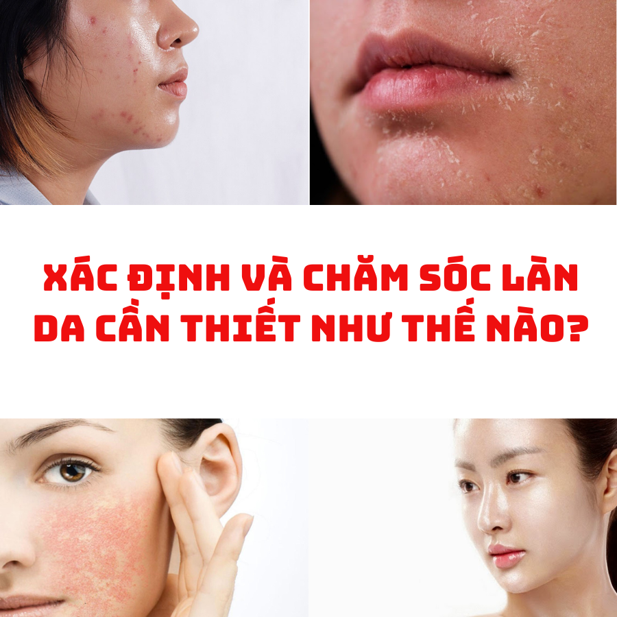 Xác Định Và Chăm Sóc Làn Da Cần Thiết Như Thế Nào?