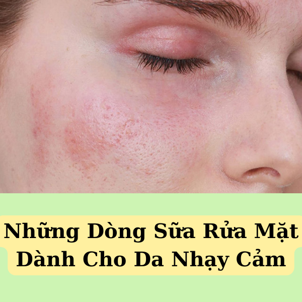 Sữa Rửa Mặt Chuyên Dành Cho Da Nhạy Cảm Giá Phù Hợp Với Học Sinh, Sinh Viên