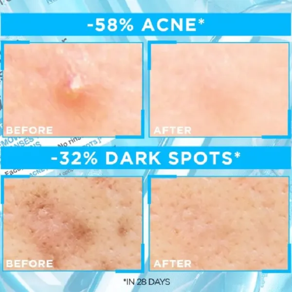 Gel Rửa Mặt Garnier Sạch Thoáng Dịu Nhẹ Cho Da Dầu Mụn 120ml