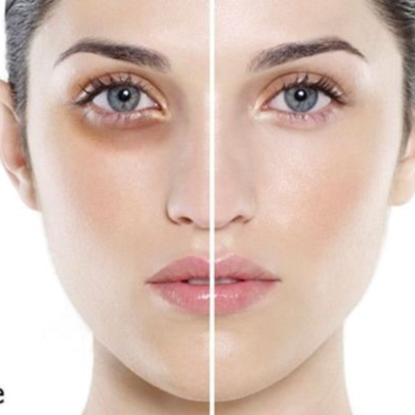 Kem Trị Quầng Thâm Mắt Kumargic Hadariki 20g