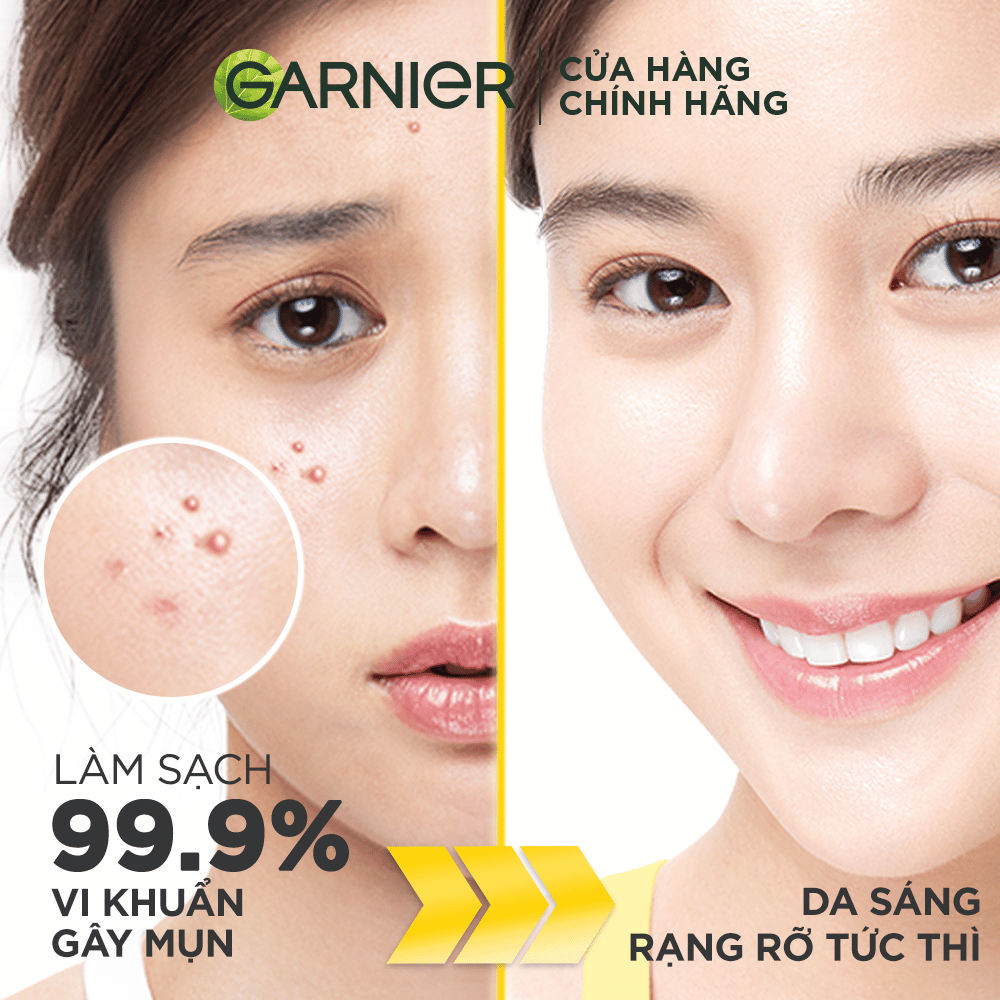 Sữa Rửa Mặt Garnier 3 Trong 1 Ngừa Mụn 100ml (Mới) Bright Complete Anti-Acne Cleansing Foam