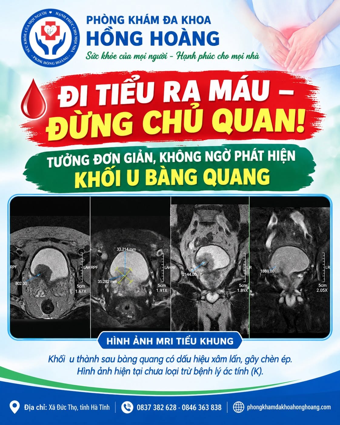 ĐI TIỂU RA MÁU – ĐỪNG CHỦ QUAN!