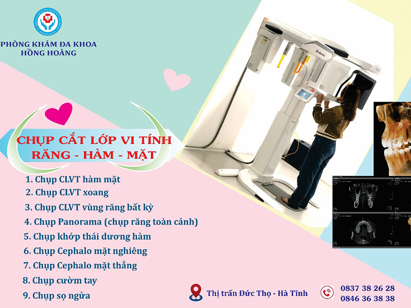 Chụp CLVT Răng - Hàm - Mặt