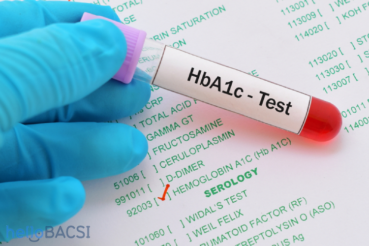 NHỮNG LỢI THẾ CỦA XÉT NGHIỆM HBA1C SO VỚI GLUCOSE MÁU MÀ BẠN NÊN BIẾT