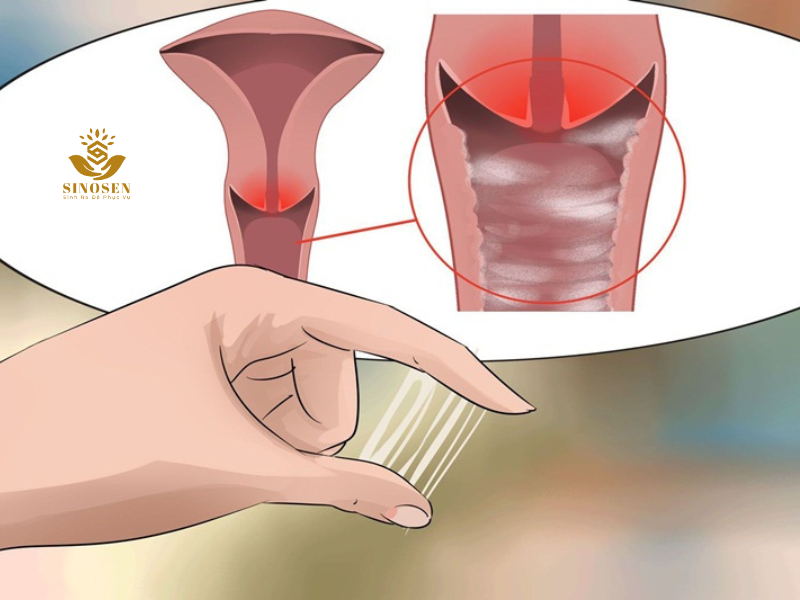 Các đặc điểm thường gặp của khí hư Các đặc điểm thường gặp của khí hư