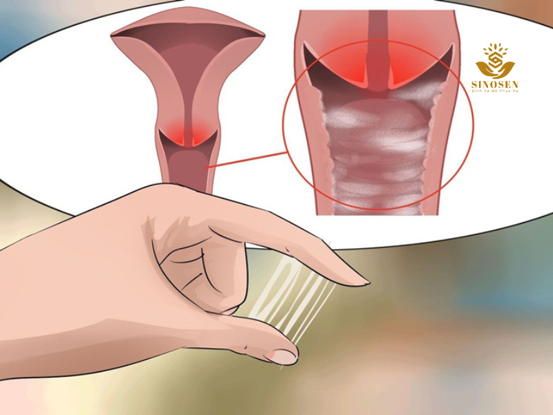 Khái niệm chung về huyết trắng Khái niệm chung về huyết trắng