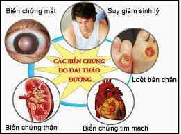 Các biến chứng mạch ở người bệnh tiểu đường mà bạn cần nắm được