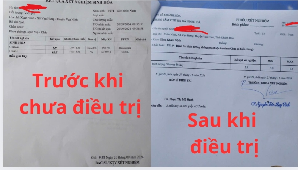 Tiểu đường có hết được không? Phác đồ điều trị từ đông y cổ truyền