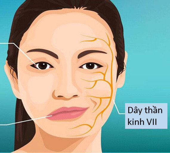 Các Biện Pháp Tập Luyện Hỗ Trợ Phục Hồi Cho Người Bị Liệt Mặt
