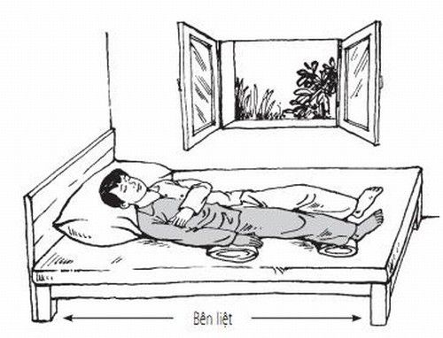 Người bị liệt nửa người chăm sóc và cách điều trị