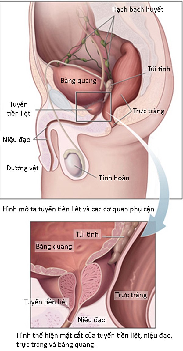 Phì Đại Tuyến Tiền Liệt và Cách Kiểm Soát Tiểu Buốt, Tiểu Rắt