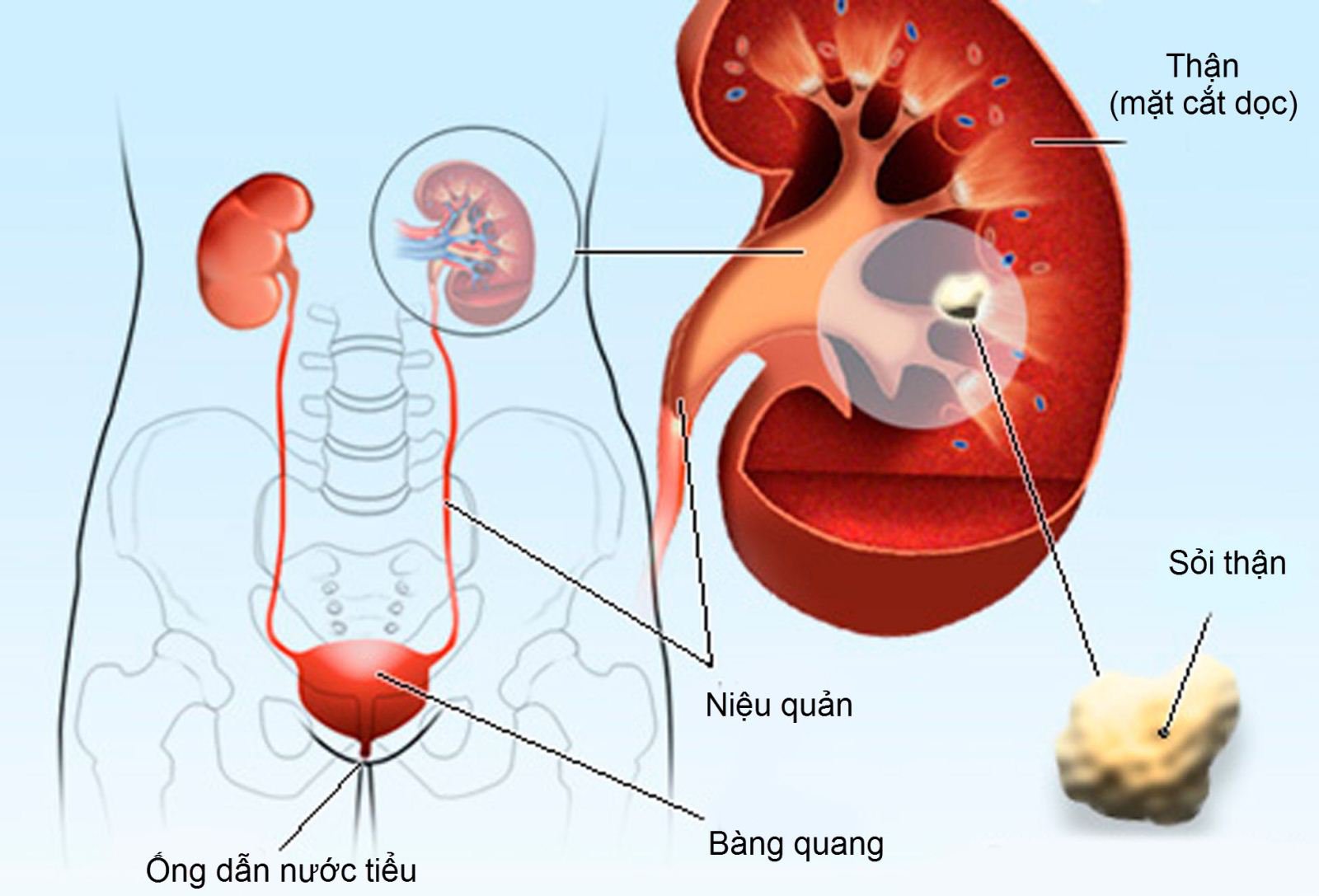 Một số nguyên nhân ảnh hưởng tới bệnh thận