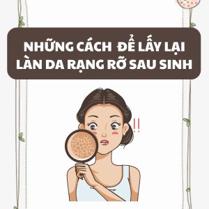 Sau sinh da xuống sắc, phải làm sao để lấy lại làn da rạng rỡ?