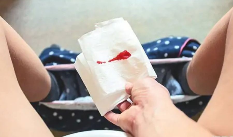 Bị Chảy Máu Khi Quan Hệ Bằng Tay: Nguyên Nhân Và Cách Xử Lý An Toàn