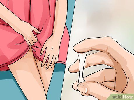Chưa Quan Hệ Có Bị Nấm Không? Sự Thật Về Nấm Âm Đạo Ở Phụ Nữ Trinh