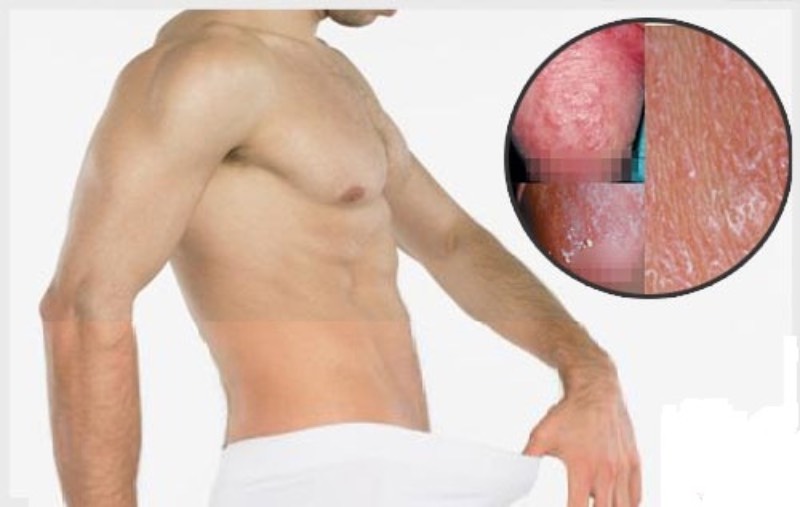 Dương Vật Bị Khô: Nguyên Nhân, Nguy Hiểm Và Cách Khắc Phục Hiệu Quả