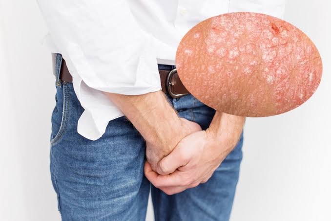 Dương Vật Bị Khô: Nguyên Nhân, Nguy Hiểm Và Cách Khắc Phục Hiệu Quả