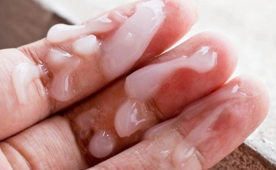 Nguyên Nhân Gây Tinh Trùng Yếu Ở Nam Giới Và Cách Cải Thiện Hiệu Quả