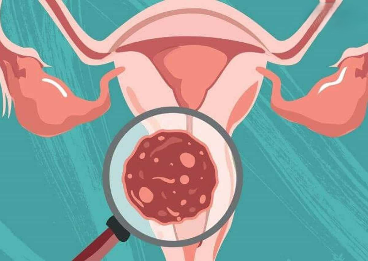 Quan Hệ Đồng Giới Có Bị Nhiễm HPV Không? Rủi Ro Và Cách Phòng Ngừa