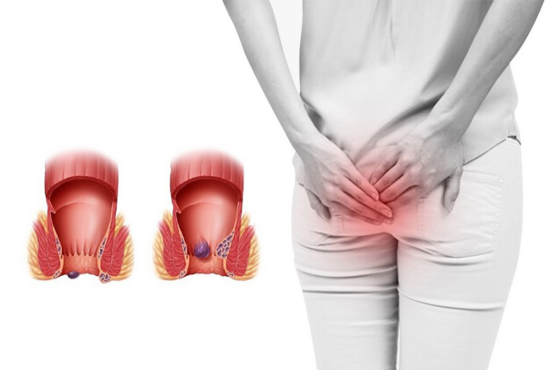 Quan Hệ Hậu Môn Có Mang Thai Không? Lưu Ý An Toàn Cần Biết