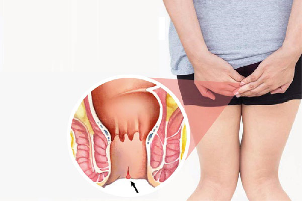Quan Hệ Hậu Môn Có Mang Thai Không? Lưu Ý An Toàn Cần Biết