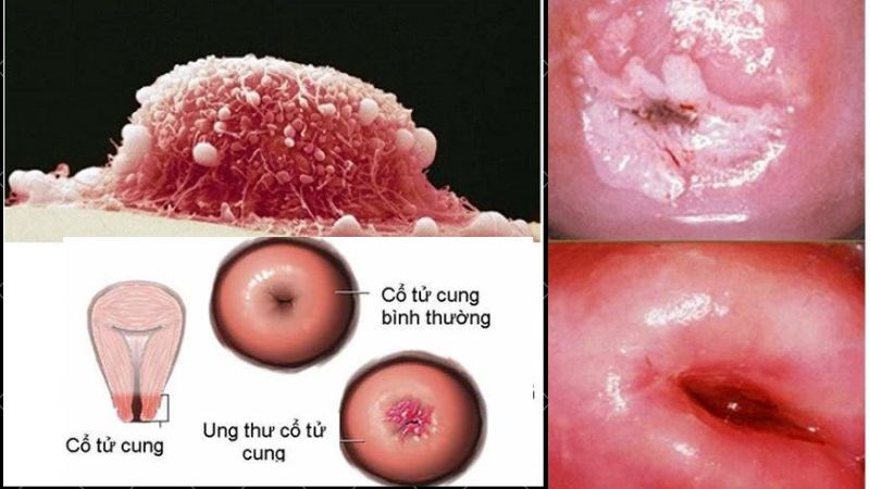 Vùng Kín Có Mùi Hôi Là Bệnh Gì? 5 Nguyên Nhân Thường Gặp Và Lưu Ý