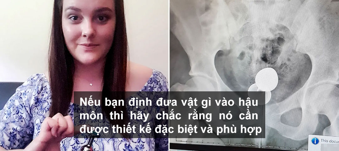 Nếu bạn định đưa vật gì vào hậu môn thì hãy chắc rằng nó cần được thiết kế đặc biệt và phù hợp