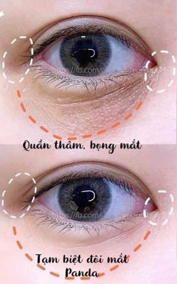 Tinh Chất Serum Dưỡng Mắt NMN Eyes All In One Memoto Omoi Essence