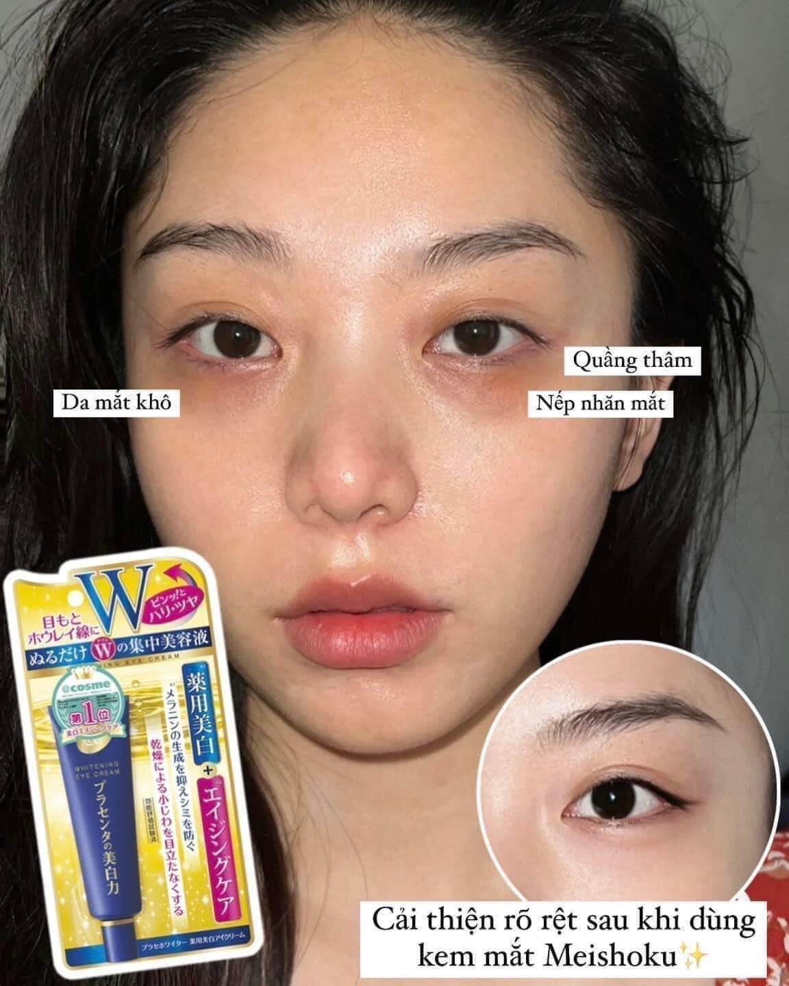 Kem mắt meishoku Nhật Bản