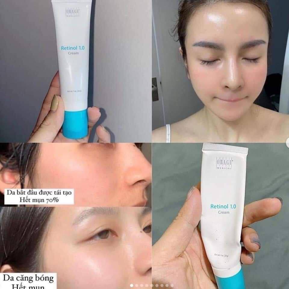 Kem Dưỡng Obagi Retinol 1.0% Trẻ Hóa Da, Ngừa Mụn 28g Retinol 1.0 Cream