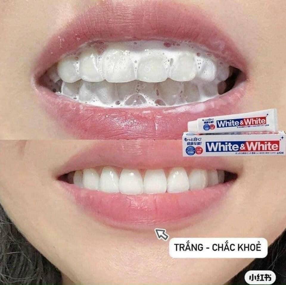 Kem Đánh Trắng Răng White & White Nhật Bản 150G