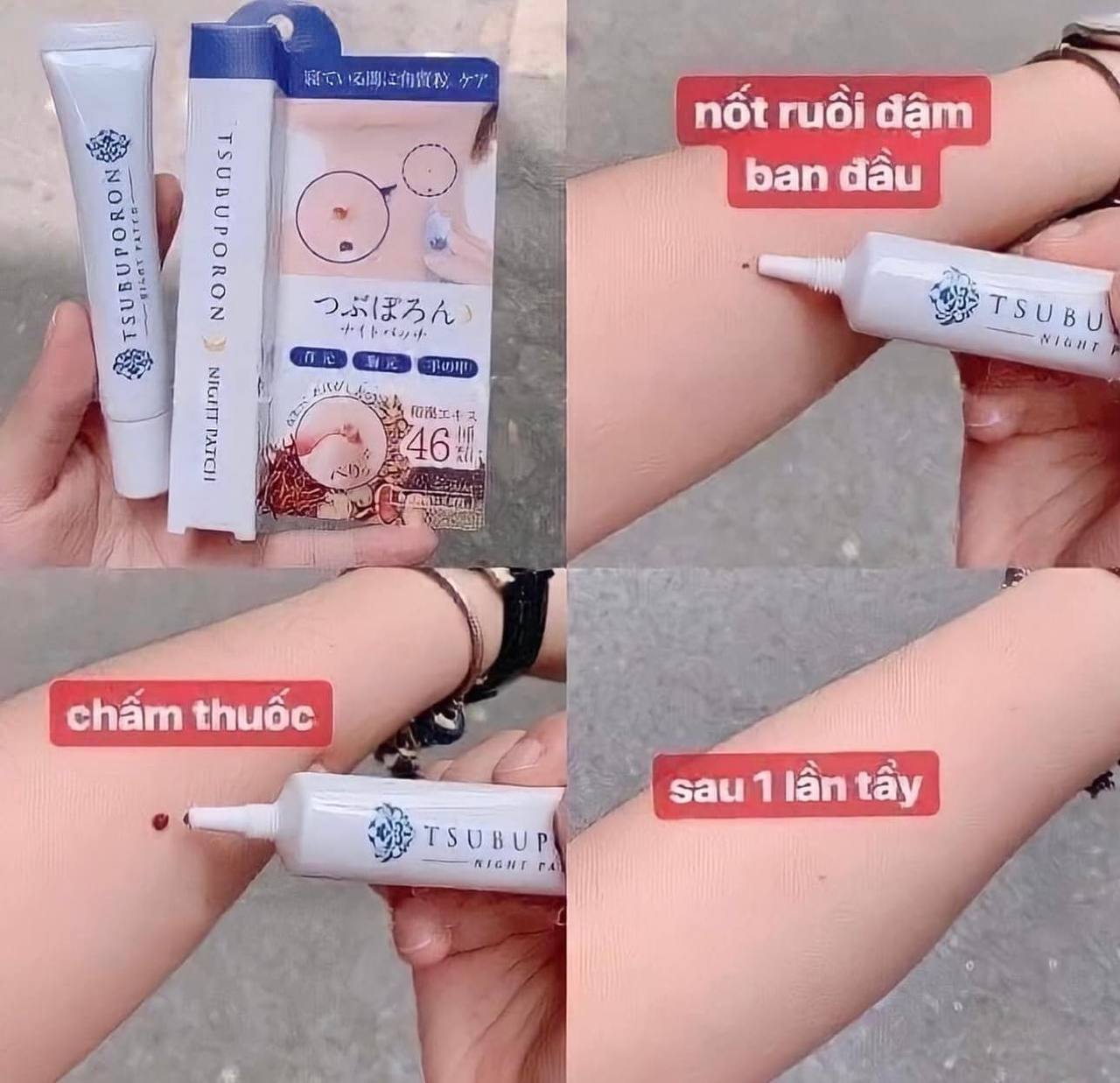 Serum trị mụn thịt mụn ruồi Tsubuporon Nhật Bản