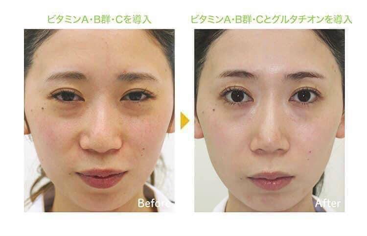Serum Vitano Vitamin C Vitano C Concentrated Serum