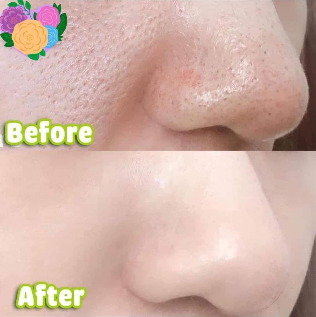 Tinh chất serum SVR 30ml