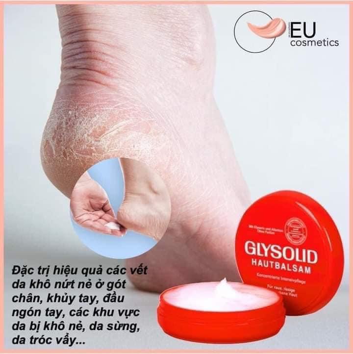 Kem dưỡng da trị nứt nẻ gót á sừng Glysolid Đức