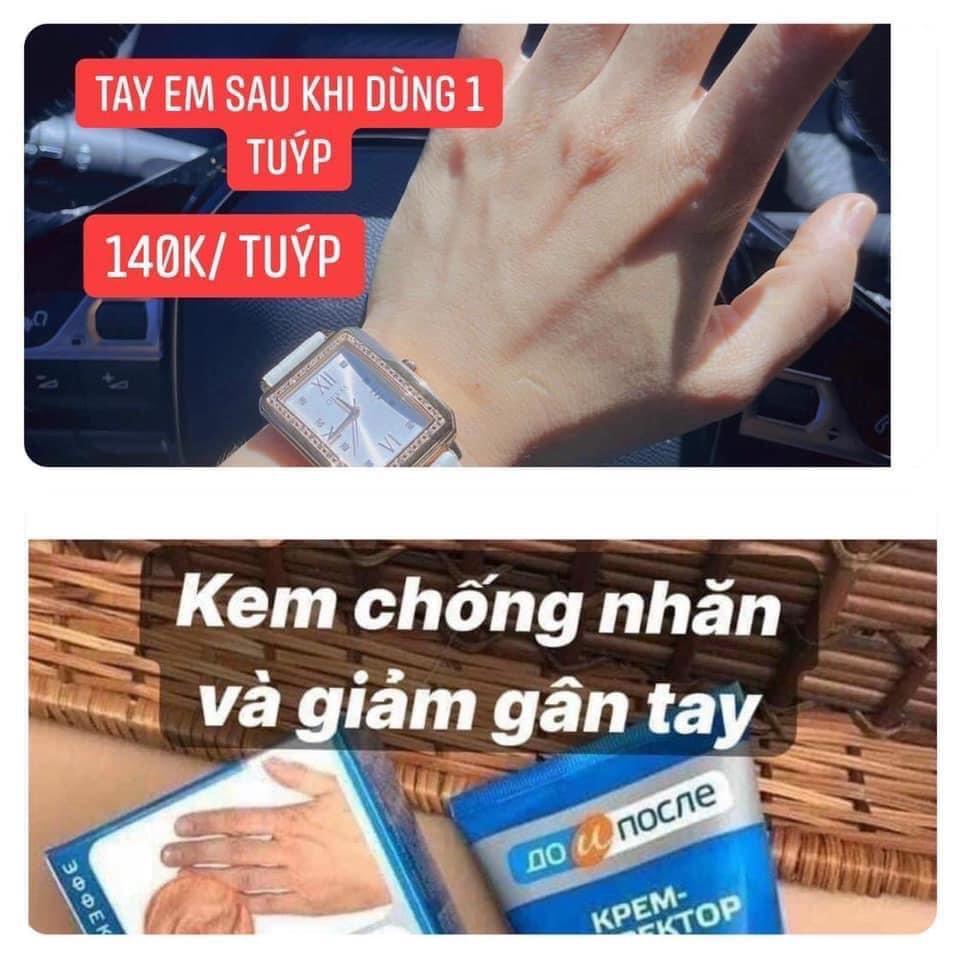 Kem dưỡng tay Kpem chống nhăn tay và trị gân tay